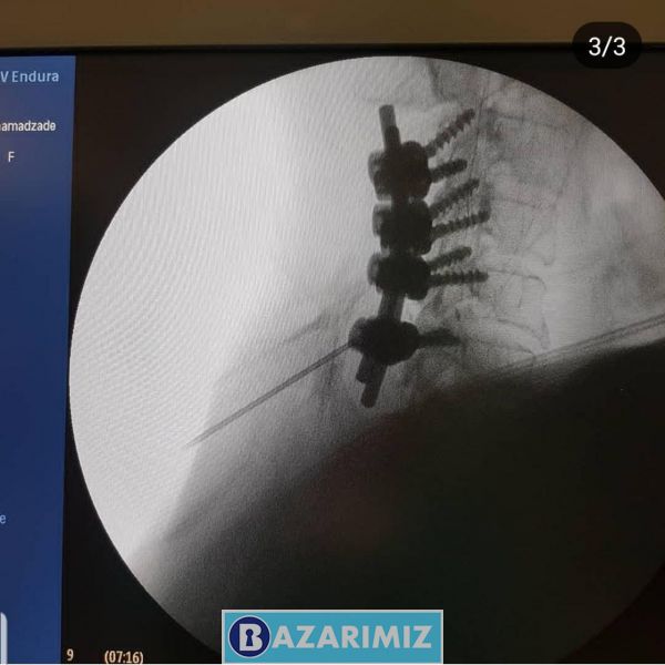 دکتر بهزاد سینایی فوق تخصص درد و طب تسکینی در بیمارستان امید